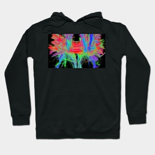 Corpus callosum, DTI MRI scan (C017/7044) Hoodie